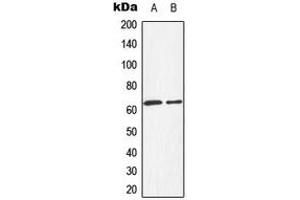 Western blot analysis of HEXB expression in HepG2 (A), HeLa (B) whole cell lysates.