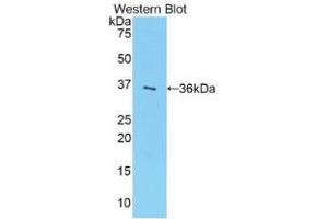 Western blot analysis of the recombinant protein. (SULT1A1 antibody  (AA 3-291))