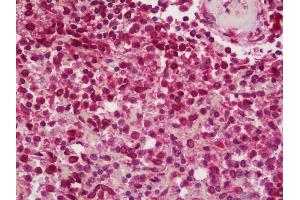 Anti-BCAR1 / p130Cas antibody IHC staining of human spleen. (BCAR1 antibody  (AA 275-325))