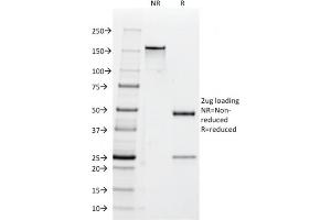 SDS-PAGE Analysis Purified CD47 Mouse Monoclonal Antibody (B6H12.
