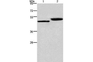 Western Blot analysis of Human stomach cancer and Mouse stomach tissue using Cathepsin E Polyclonal Antibody at dilution of 1:450 (Cathepsin E antibody)
