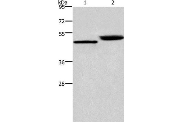 Cathepsin E antibody