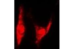 Immunofluorescent analysis of PSMD8 staining in U2OS cells. (PSMD8 antibody)