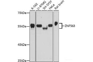 Western blot analysis of extracts of various cell lines using ZNF563 Polyclonal Antibody at dilution of 1:1000. (ZNF563 antibody)