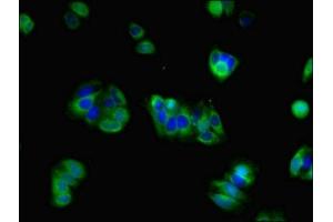 Immunofluorescent analysis of HepG2 cells using ABIN7153987 at dilution of 1:100 and Alexa Fluor 488-congugated AffiniPure Goat Anti-Rabbit IgG(H+L) (NMDAR2A antibody  (AA 501-750))
