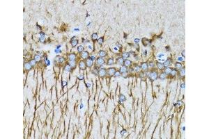 Immunohistochemistry of paraffin-embedded Mouse brain using MAP1LC3A Polyclonal Antibody at dilution of 1:100 (40x lens). (MAP1LC3A antibody)