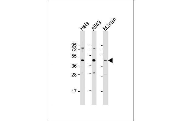 G6PC3 antibody  (AA 215-246)