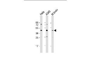 All lanes : Anti-G6PC3 Antibody (C-Term) at 1:1000 dilution Lane 1: Hela whole cell lysate Lane 2: A549 whole cell lysate Lane 3: mouse brain lysate Lysates/proteins at 20 μg per lane. (G6PC3 antibody  (AA 215-246))
