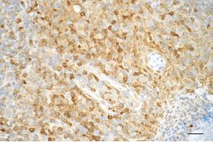 Immunohistochemistry was performed on paraffin-embedded human tonsillitis using pro caspase 3 antibody (ABIN7799900), 1:200).