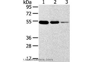 Western blot analysis of Human thyroid and esophagus cancer, human normal rectum tissue, using TMPRSS11F Polyclonal Antibody at dilution of 1:500 (TMPRSS11F antibody)