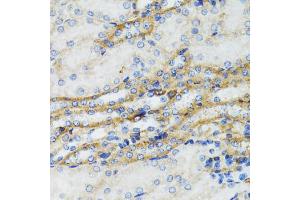 Immunohistochemistry of paraffin-embedded mouse kidney using SERPING1 antibody (ABIN6290125) at dilution of 1:100 (40x lens). (SERPING1 antibody)