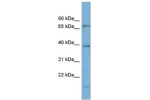 WB Suggested Anti-HP1BP3 Antibody Titration: 0.