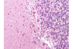 Immunohistochemistry (Paraffin-embedded Sections) (IHC (p)) image for anti-KISS1 Receptor (KISS1R) (Extracellular Domain) antibody (ABIN1048994)