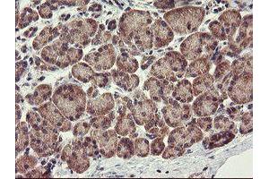 Image no. 1 for anti-rho GTPase Activating Protein 2 (ARHGAP2) antibody (ABIN1499629) (CHN1 antibody)