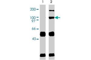 Immunoprecipation results using western blot analysis. (VAV2 antibody  (AA 287-578))