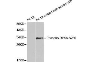 Western blot analysis of extracts from PC12 cells untreated or treated with anisomycin, using phospho-RPS6-S235 antibody. (RPS6 antibody  (pSer235))