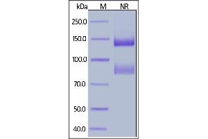 Biotinylated Human ITGAV&ITGB6 Heterodimer Protein, His,Avitag&Tag Free on  under ing (NR) condition. (ITGAV/ITGB6 Protein (AA 31-992) (His tag,AVI tag,Biotin))