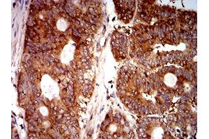Immunohistochemistry (IHC) image for anti-Eukaryotic Translation Initiation Factor 5 (EIF5) (AA 1-300) antibody (ABIN5865324) (EIF5 antibody  (AA 1-300))