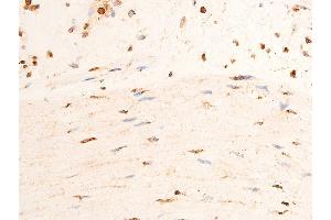 Immunohistochemistry (IHC) image for anti-Checkpoint Kinase 2 (CHEK2) (pThr383) antibody (ABIN6256552)