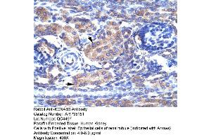 Human kidney (KCNAB3 antibody  (N-Term))