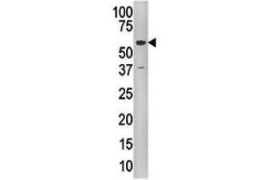 Western blot analysis of Tip60 antibody and CEM cell line lysate (KAT5 antibody  (AA 467-498))