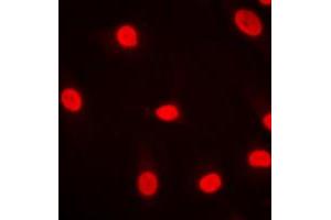 Immunofluorescent analysis of MZF1 staining in HeLa cells. (MZF1 antibody  (N-Term))