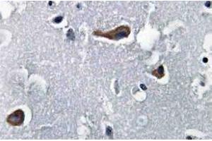 Immunohistochemistry (IHC) analyzes of MAP-2 antibody in paraffin-embedded human brain tissue. (MAP2 antibody)