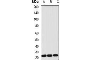 Western blot analysis of IL-1RA expression in Hela (A), NIH3T3 (B), HL60 (C) whole cell lysates. (IL1RN antibody)
