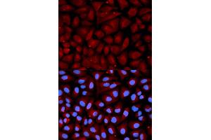 Immunofluorescence analysis of U2OS cells using SERPINC1 antibody (ABIN5970755). (SERPINC1 antibody)