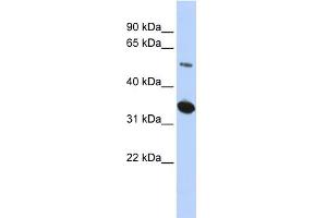 WB Suggested Anti-KIAA0157 Antibody Titration: 0.