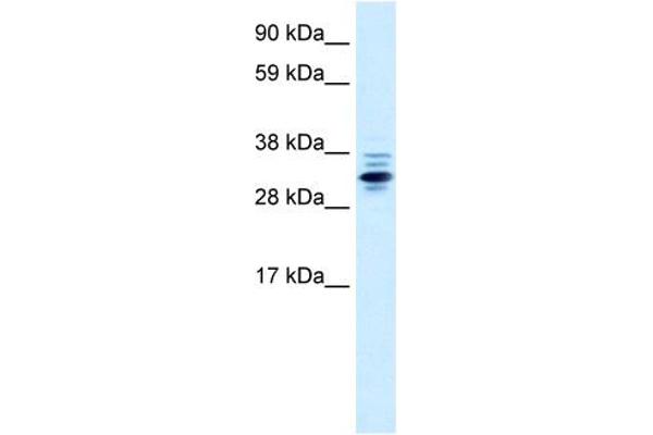 ZNF654 antibody  (Middle Region)