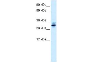ZNF654 antibody  (Middle Region)
