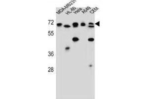Western Blotting (WB) image for anti-acetylserotonin O-Methyltransferase-Like (ASMTL) antibody (ABIN2997228) (ASMTL antibody)