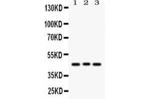 Western blot analysis of Ataxin 3 using anti-Ataxin 3 antibody .
