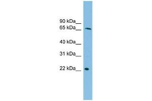 WB Suggested Anti-DYRK3 Antibody Titration:  0. (DYRK3 antibody  (N-Term))