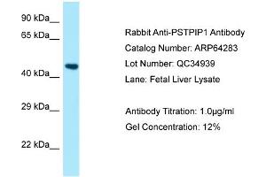 Western Blotting (WB) image for anti-Proline-serine-threonine Phosphatase Interacting Protein 1 (PSTPIP1) (N-Term) antibody (ABIN2789789) (PSTPIP1 antibody  (N-Term))