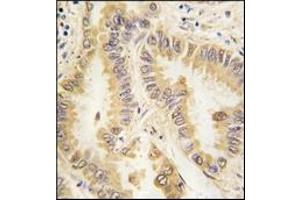 Immunohistochemistry (IHC) image for anti-Superoxide Dismutase 2, Mitochondrial (SOD2) antibody (ABIN356396)