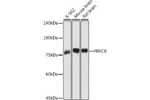Western blot analysis of extracts of various cell lines, using PRKCB antibody (ABIN6128462, ABIN6146199, ABIN6146201 and ABIN6217699) at 1:1000 dilution. (PKC beta antibody  (AA 1-270))