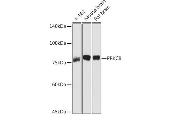 PKC beta antibody  (AA 1-270)