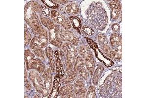 Immunohistochemical staining of human kidney with RPS15A polyclonal antibody  shows strong cytoplasmic positivity in cells in tubules at 1:10-1:20 dilution. (RPS15A antibody)