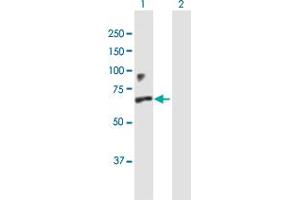 Western Blot analysis of IFNAR1 expression in transfected 293T cell line by IFNAR1 MaxPab polyclonal antibody. (IFNAR1 antibody  (AA 1-557))