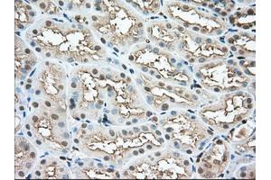 Immunohistochemical staining of paraffin-embedded Human pancreas tissue using anti-PFN1 mouse monoclonal antibody. (PFN1 antibody)