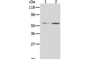Western Blot analysis of Hela and 293T cell using AKR1B1 Polyclonal Antibody at dilution of 1:350 (AKR1B1 antibody)