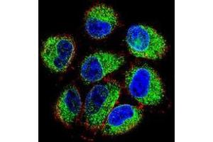 Confocal immunofluorescent analysis of TBC1D13 Antibody (Center) Cat. (TBC1D13 antibody  (Middle Region))