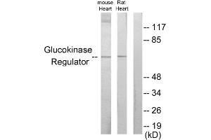 Western blot analysis of extracts from mouse heart cells and rat heart cells, using Glucokinase Regulator antibody. (GCKR antibody  (Internal Region))