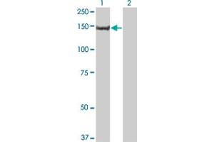 Western Blot analysis of PIK3R4 expression in transfected 293T cell line by PIK3R4 monoclonal antibody (M03), clone 1G12. (PIK3R4 antibody  (AA 1259-1358))
