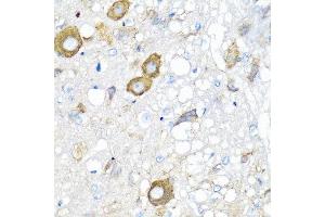 Immunohistochemistry of paraffin-embedded rat brain using MGP antibody at dilution of 1:100 (40x lens).
