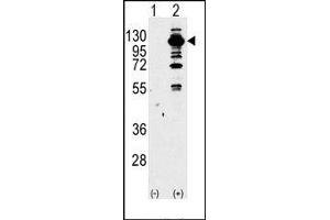 Image no. 1 for anti-Phosphoinositide-3-Kinase, Catalytic, gamma Polypeptide (PIK3CG) (Middle Region) antibody (ABIN360713) (PIK3 gamma antibody  (Middle Region))