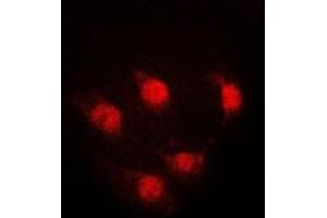 Immunofluorescent analysis of STAT5A staining in K562 cells. (STAT5A antibody  (Center))