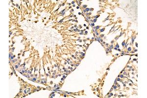 ABIN6258097 and ABIN6274226 at 1/100 staining Rat testis tissue by IHC-P.